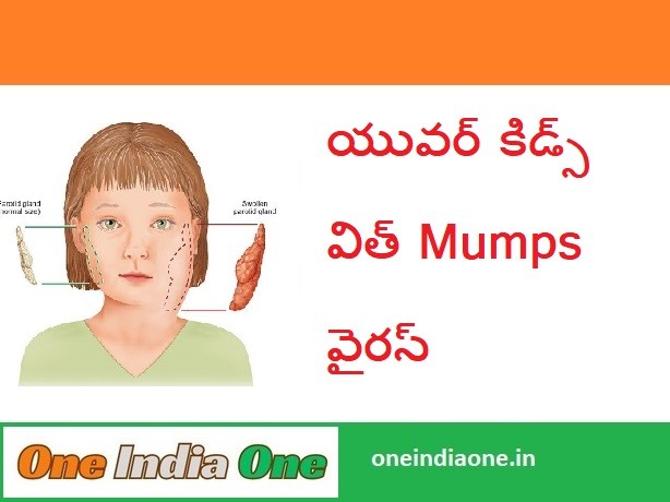 Mumps Virus